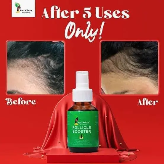 زيت رو أفريكانا لتعزيز بصيلات الشعر